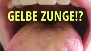 Was tun gegen eine gelb belegte Zunge?